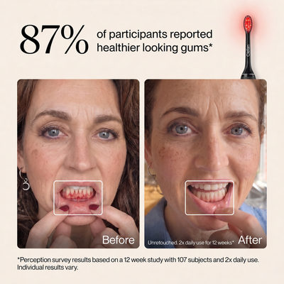 Cielan Gum Recovery Pro Toothbrush