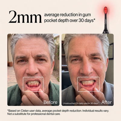 Cielan Gum Recovery Pro Toothbrush