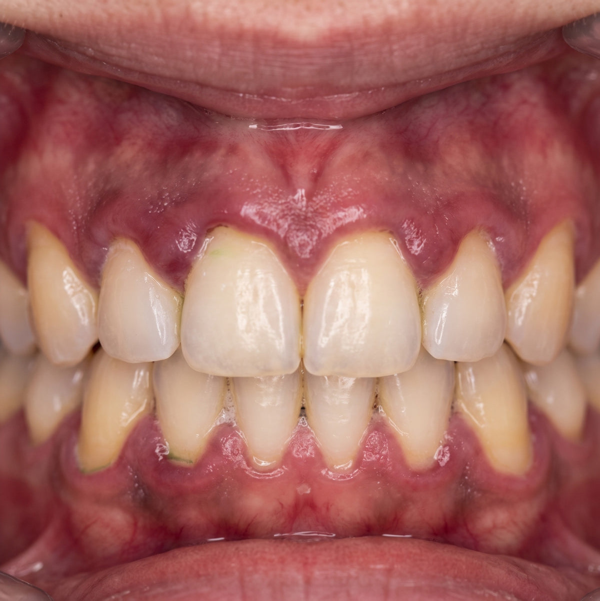 Day 01